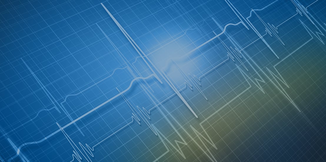 Graphic of ectrocardiogram readings in white atop a blue and gold background
